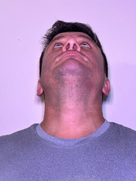 Preview undefined